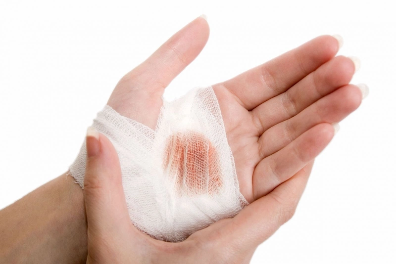 Hướng dẫn một số mẹo sơ cứu cầm máu tại nhà 3