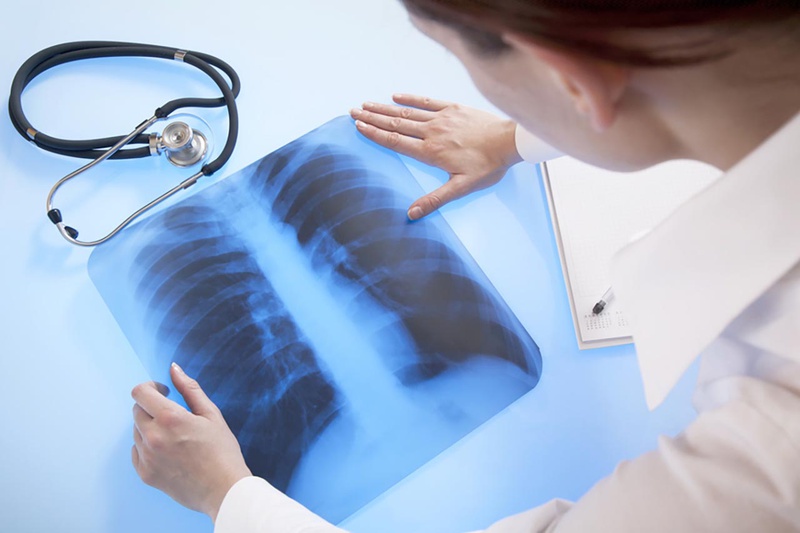 Hướng dẫn phòng ngừa viêm phổi bệnh viện hiệu quả 3