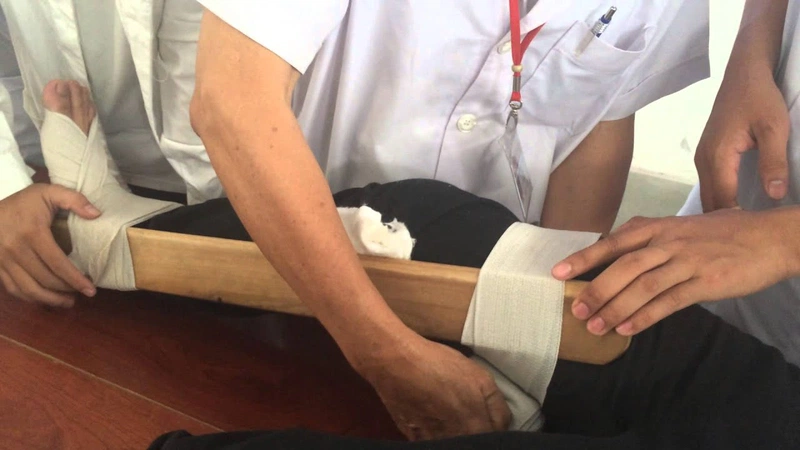 Hướng dẫn sơ cứu gãy chân đúng cách 2