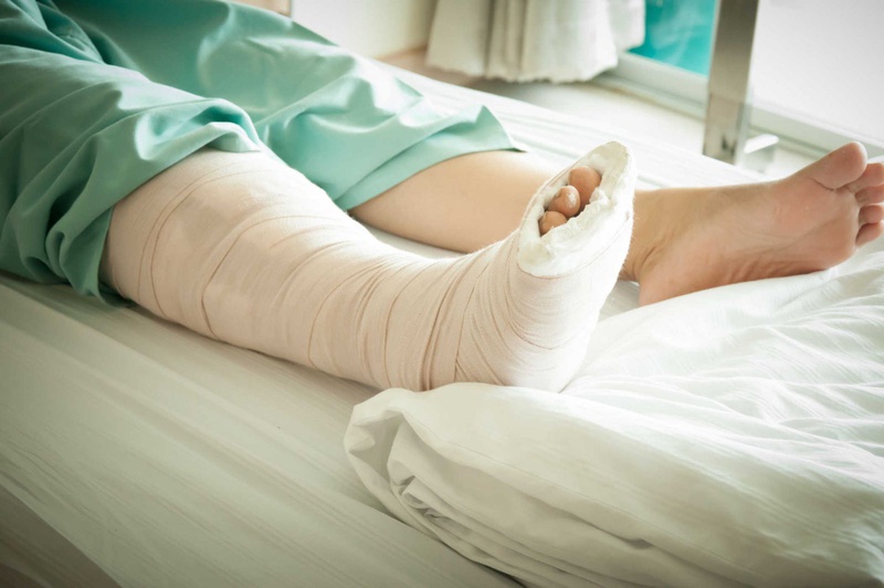 Hướng dẫn sơ cứu gãy chân đúng cách 4