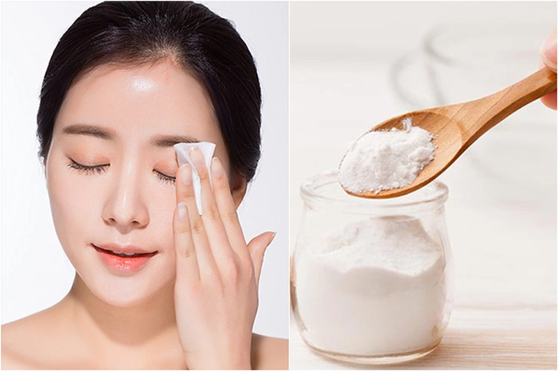 Bật mí 3 cách trị mụn bằng baking soda hiệu quả nhanh chóng