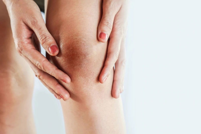 Đầu gối bị thâm có thể là do yếu tố di truyền