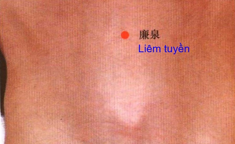 Huyệt Liêm Tuyền là huyệt gì? Cách phối hợp huyệt như thế nào? 1