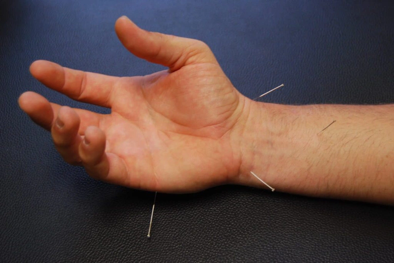 Huyệt Thông Lý ở đâu và tác dụng của huyệt đối với sức khỏe con người là gì?3