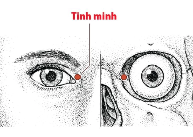 Huyệt tình minh là huyệt đạo nằm ở vị trí gần mắt