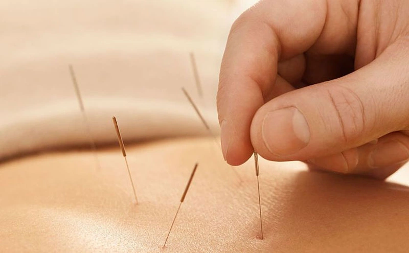 Huyệt trung cực là gì? Huyệt trung cực nằm ở đâu? 2