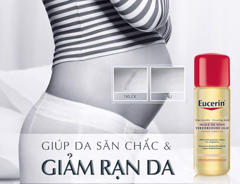 kem trị rạn da eucerin 1