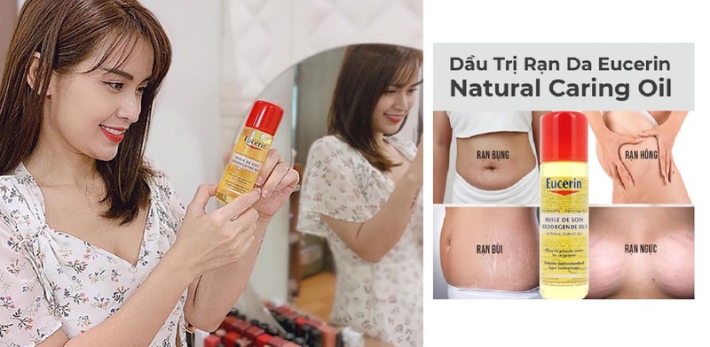 kem trị rạn da eucerin 4