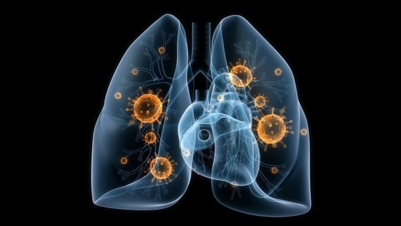Nhiễm khuẩn đường hô hấp là tình trạng các cơ quan của bộ máy hô hấp bị nhiễm khuẩn
