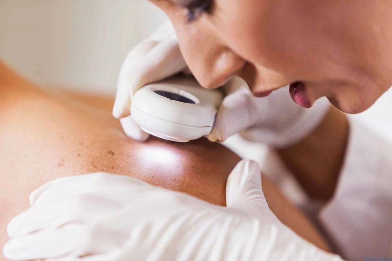 Khi bị giời leo cần có chế độ nghỉ ngơi ăn uống hợp lý