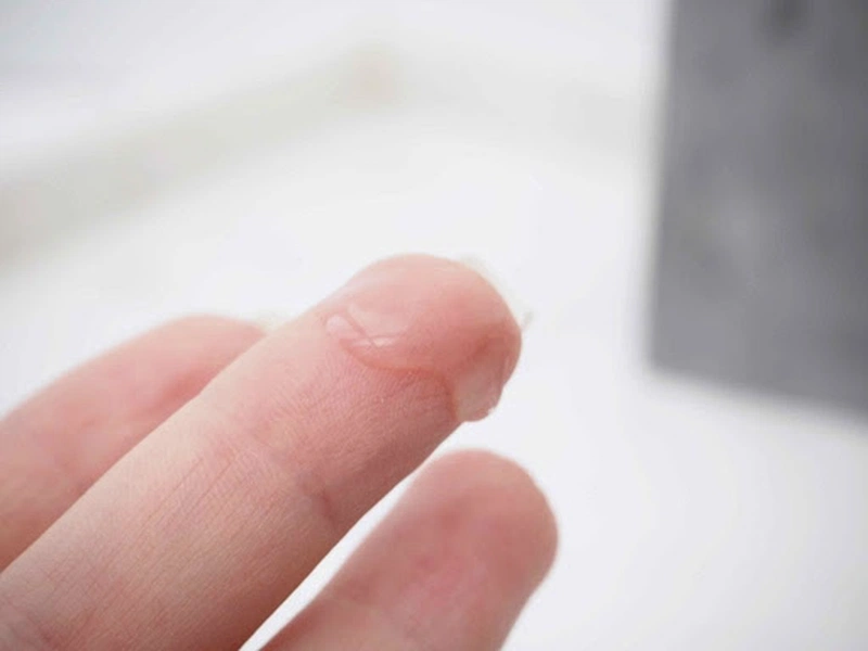 Những chia sẻ chi tiết về khí hư bất thường ở chị em phụ nữ