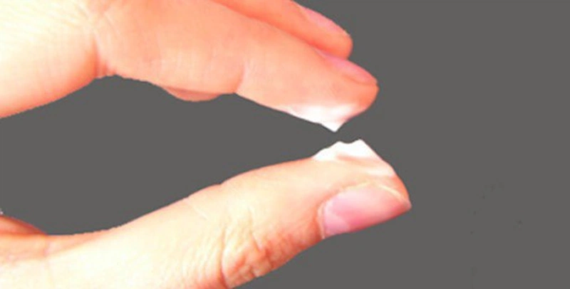Những biện pháp phòng tránh khí hư bị vón cục