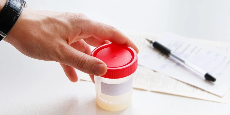 Khí hư ở nam giới là gì? Dấu hiệu khí hư bất thường nam giới nên biết? 3