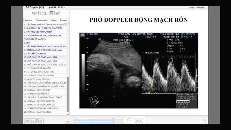 Khi nào mẹ cần thực hiện siêu âm Doppler thai nhi 2
