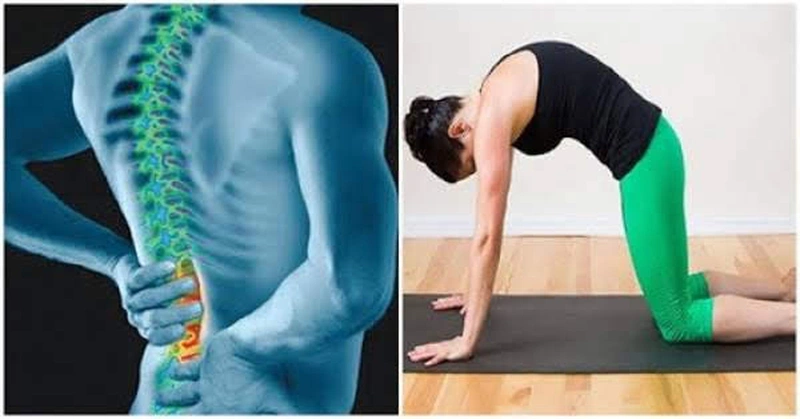 Triệu chứng tập yoga bị đau lưng