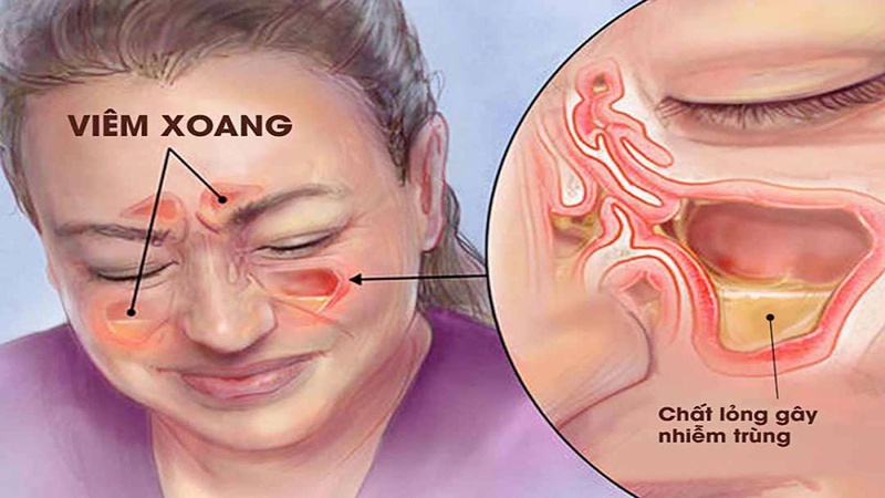 Khó thở khi nằm là do đâu? Cần làm gì khi gặp hiện tượng này? 2