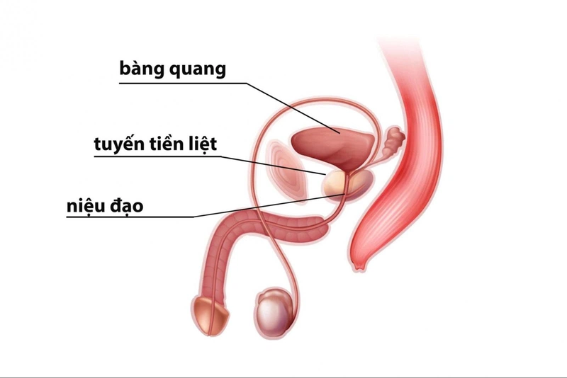 Kích thước tiền liệt tuyến như thế nào là bình thường?