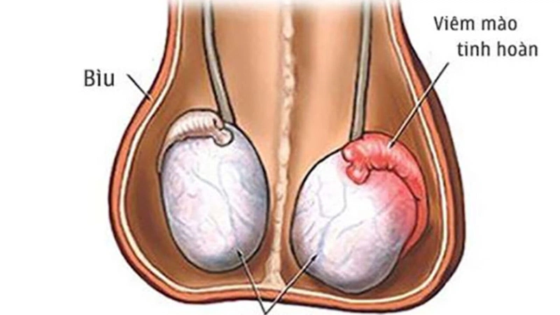 Kích thước tinh hoàn bình thường là bao nhiêu?2
