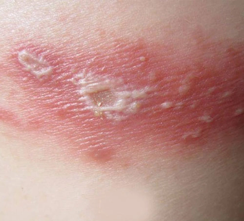 Kiến ba khoang sống ở đâu: Đặc điểm nhận diện và cách xử lý 3