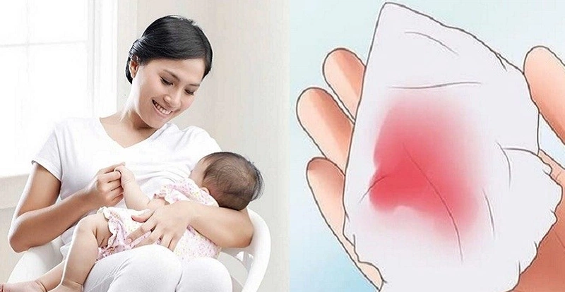 Kinh nguyệt sau sinh có màu gì? Những biểu hiện bình thường và bất thường 1