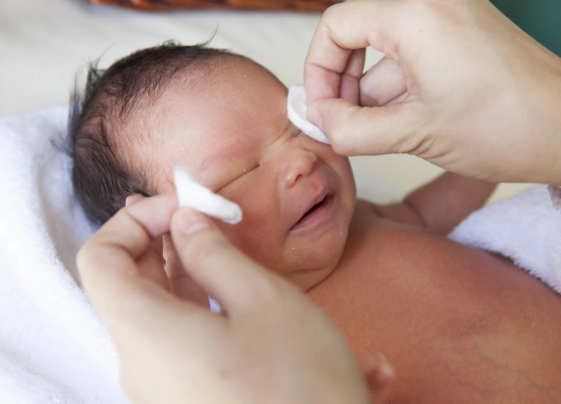 Nắm rõ cách điều trị viêm kết mạc ở trẻ sơ sinh 2