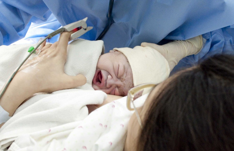 Làm cách nào để kích sữa sau sinh mổ? 2