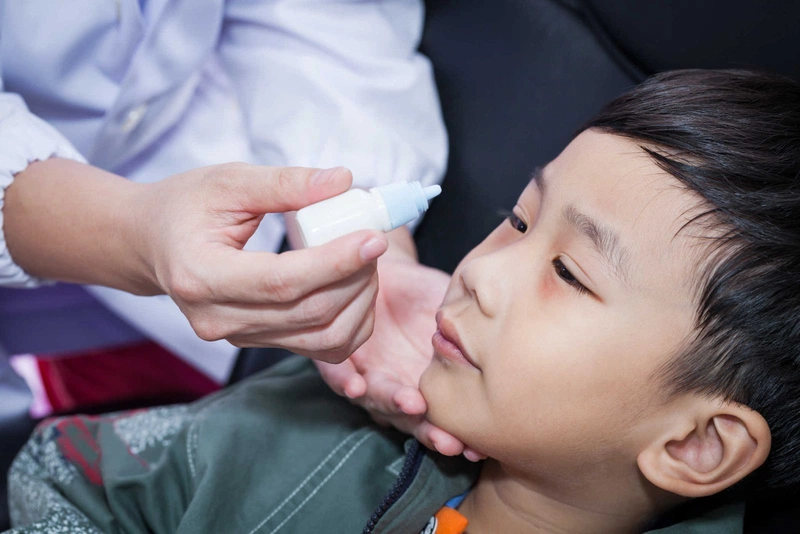 Làm gì khi bé 1 tuổi mắt bị đổ ghèn? 4