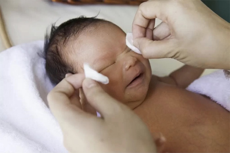 Làm gì khi trẻ sơ sinh bị đau mắt đỏ đế giúp con nhanh khỏi bệnh?1