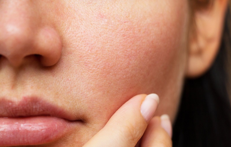 Xông mặt giúp lỗ chân lông trên mặt được giãn nở, từ đó giúp đẩy bụi bẩn ra ngoài