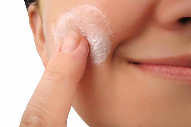 Biện pháp điều trị thông dụng nhất đối với bệnh lang ben miệng là sử dụng thuốc bôi ngoài da