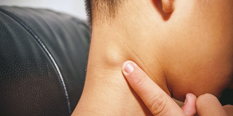 Lao hạch là gì? Chi phí mổ hạch lao có đắt không 2