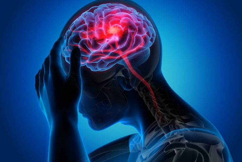 Lao màng não điều trị bao lâu thì khỏi? 1