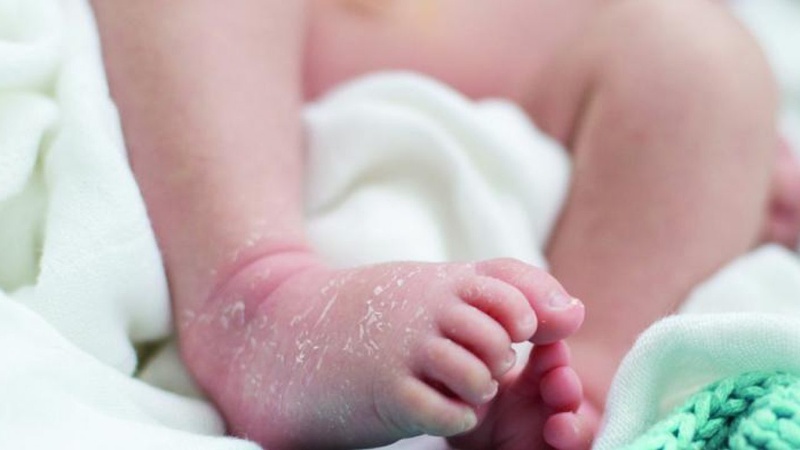 Liệu có nên sử dụng kem dưỡng ẩm cho trẻ sơ sinh ?1