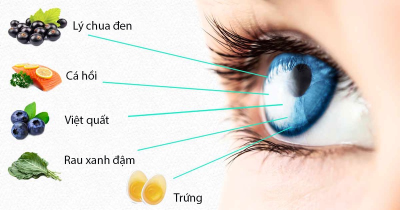 Loạn thị bao nhiêu là nặng?