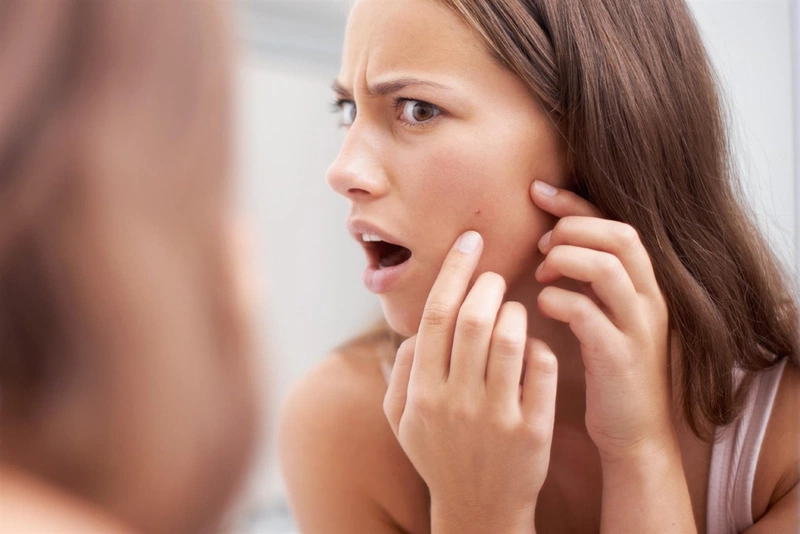 tại sao thức khuya lại nổi mụn
