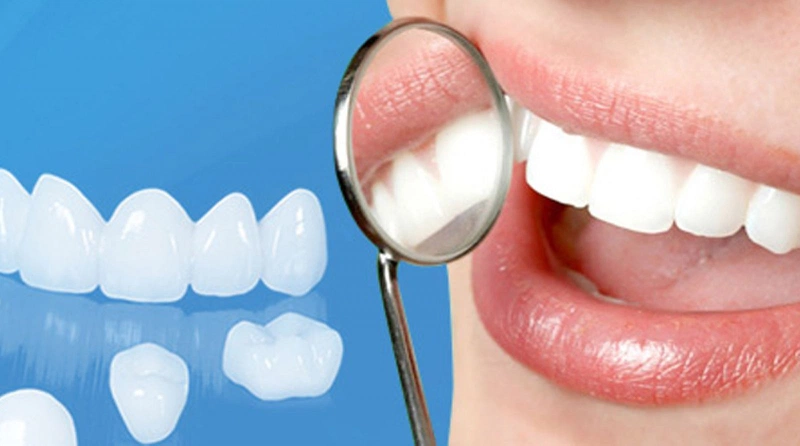 Mách bạn 6 cách làm răng đều không cần niềng2