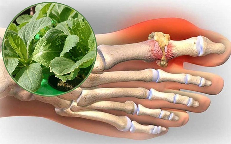Mách bạn: Cách chữa bệnh gout bằng cải bẹ xanh