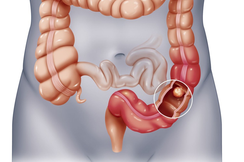 Mách chị em làm thế nào uống đậu đen xanh lòng đúng cách 2