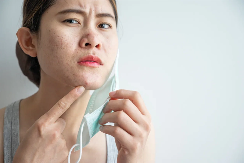 Đeo khẩu trang nhiều có sao không? 2