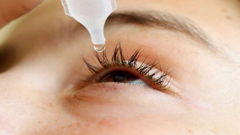 Mắt bị ghèn sợi: Nguyên nhân và xử trí 4