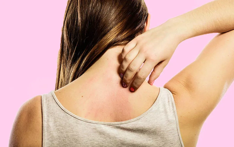 Mẹ bị dị ứng có nên cho con bú được không? 1