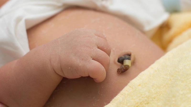 Mẹ đã biết băng rốn cho trẻ sơ sinh loại nào tốt chưa? 1