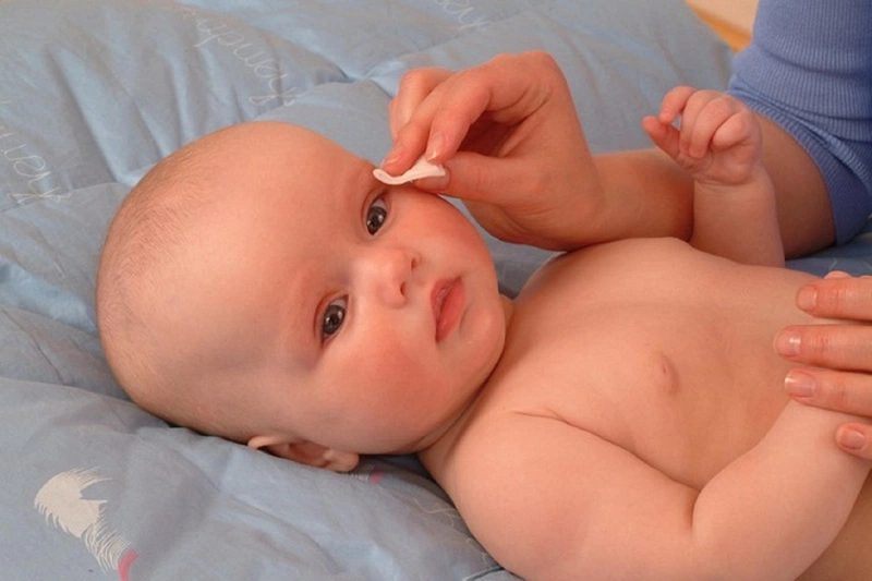 Mẹ nên làm gì khi trẻ sơ sinh bị sưng mí mắt trên? 3