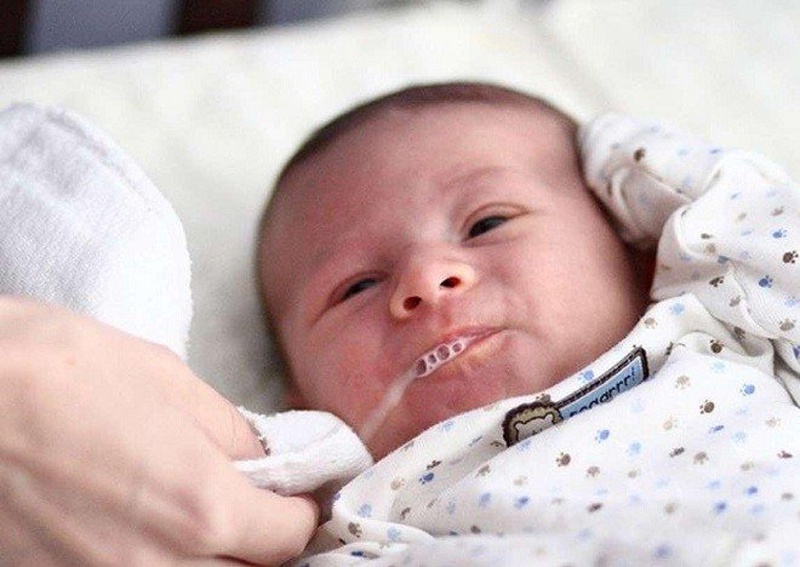 Mềm sụn thanh quản là bệnh gì? Nguyên nhân do đâu? 2