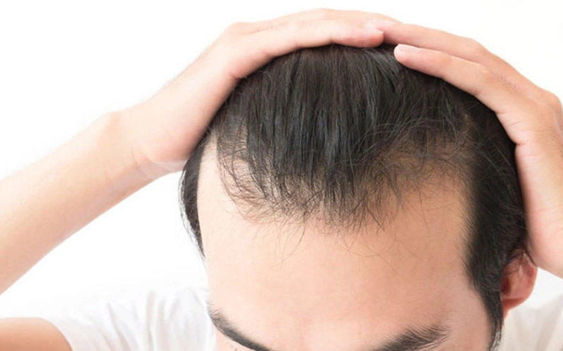 5 cách để tóc nam không bị chỉa dễ như ăn cháo