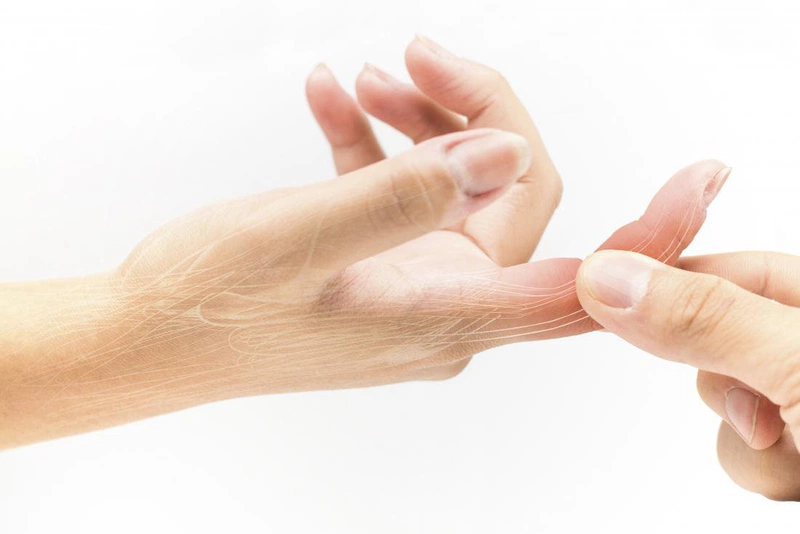 Ngón tay bị sưng tấy và khó cử động là dấu hiện điển hình nhất của bong gân ngón tay