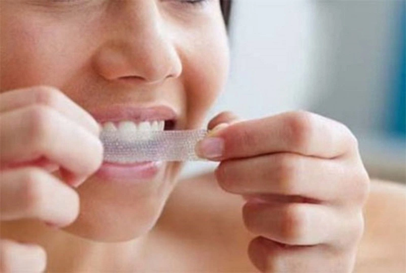 Tác hại của miếng dán trắng răng