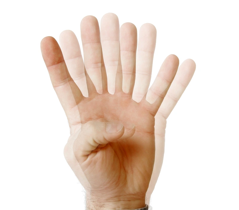 Mổ đục thủy tinh thể kiêng ăn gì? 2