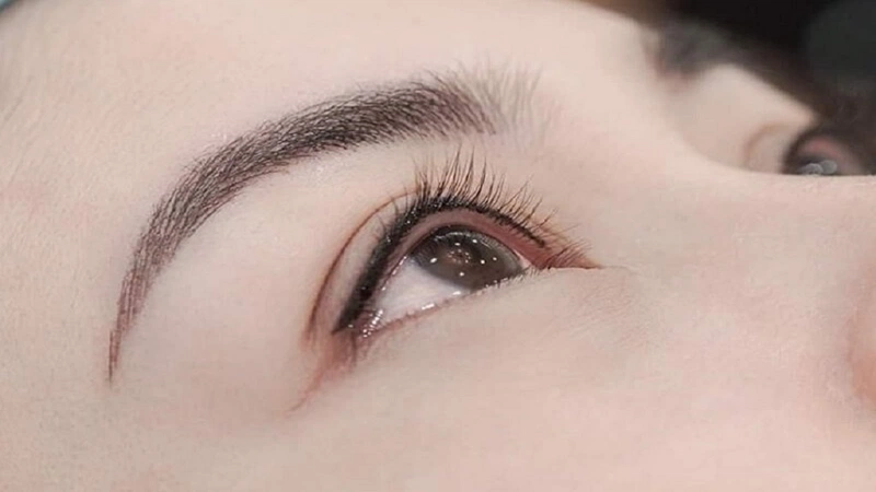 Mở góc mắt trong/ngoài khá đơn giản, nhanh chóng và có thể hồi phục ngay nhưng cần được chăm sóc đúng cách để đạt được kết quả tốt nhất