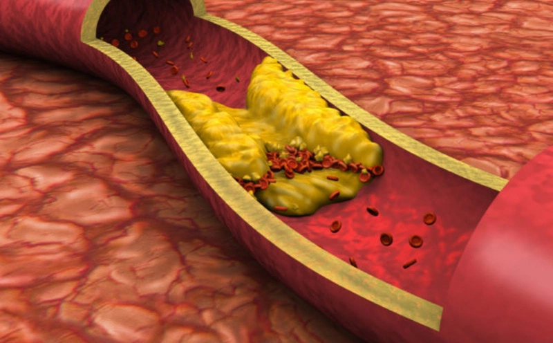 Cơ thể con người phải cân bằng cả cholesterol tốt và xấu